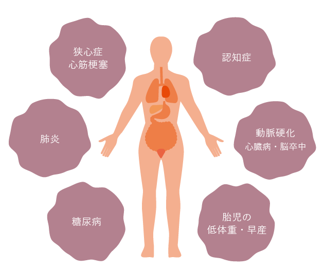 歯周病と全身疾患の関係